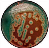 agar-bacillus-cereus